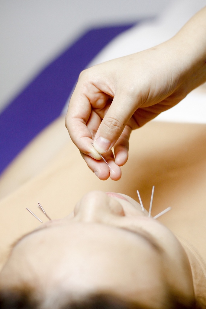 3 Sessions of Pain Management Package (Consultation + Acupuncture + Tui-na)